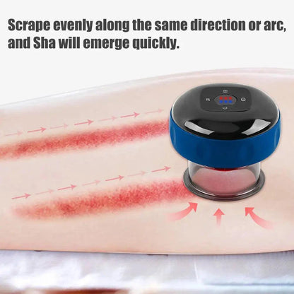 Electric Cupping Massager 1