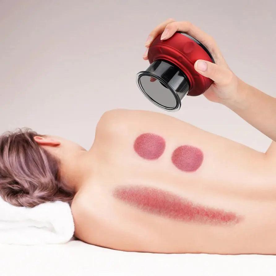 Electric Cupping Massager 1